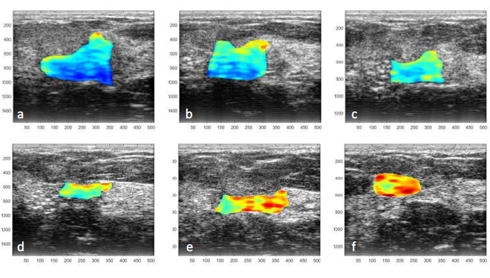 ultrasonography images 1