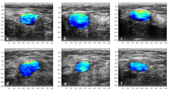 ultrasonography images 2